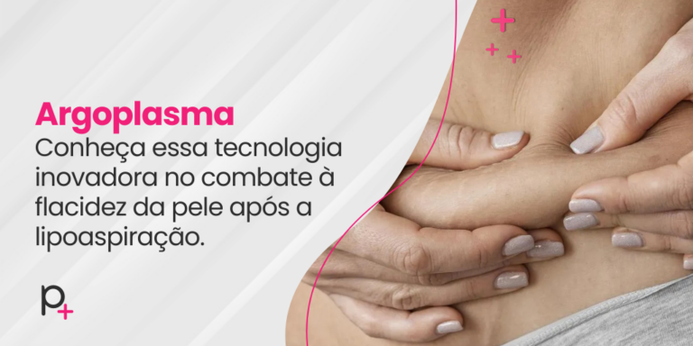 Argoplasma: conheça essa tecnologia inovadora no combate à flacidez da ...