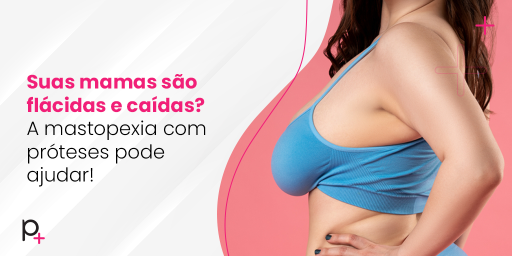 mastopexia com próteses